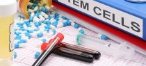 stem cells