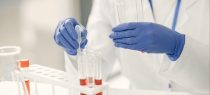Patentable Category of Claims in India- Method of Treatment or Method of Producing a Novel Substance for Medical Application?